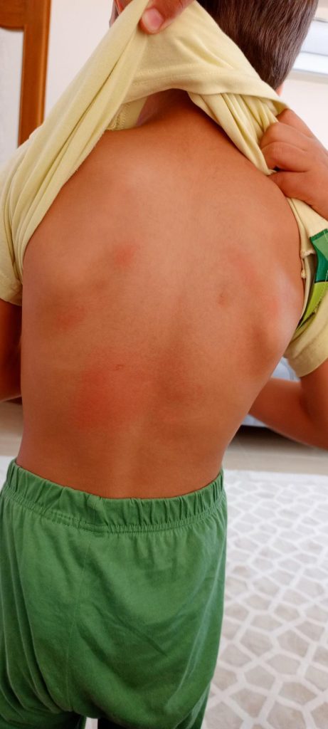 İşte Fethiye’de Otizmli Çocuğa Darp İddiası Aile Suç Duyurusunda Bulundu Haberi