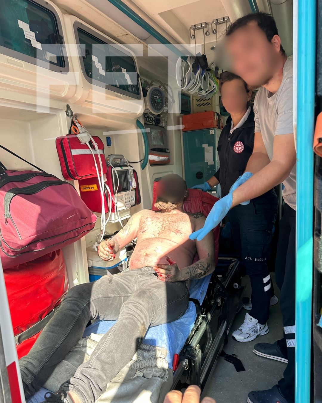 İşte Fethiye’de Bir İşletmede Yangın Çıktı: 1 Yaralı! haberi